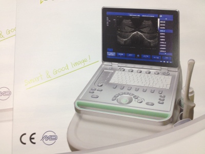 Out-patient portable color B ultrasound machine medical supplies.