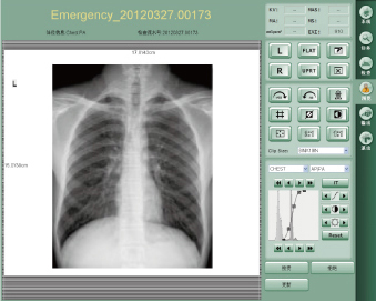 Medical Equipment Digital X- ray imaging workstation software