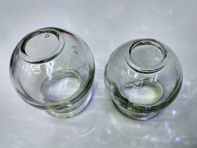 The glass cupping glass thickened cupping
