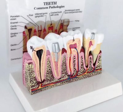 Dental model dental model of dental model.