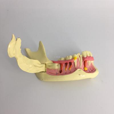 Dental model Oral model Lower right jaw decomposition model Demonstration model Dental model