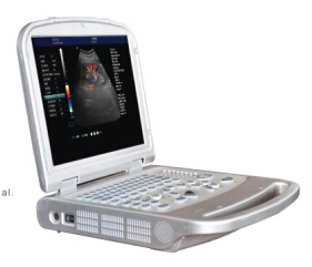 Best selling cheapest portable ultrasound machine for sale