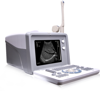 Cheap price full digital Portable ultrasound machine scanner cheaper ultrasound machine