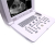 Laptop Diagnostic portable ultrasound machine for Pregnancy portable ultrasound scanner
