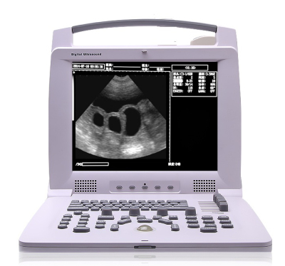 Laptop Diagnostic portable ultrasound machine for Pregnancy portable ultrasound scanner