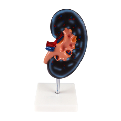 kidney model(1 part)