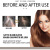 Eelhoe Hair Growth Liquid Strong Hair Nourishing Hair Root Growth Thick Damage Repair Ginger Hair Repair