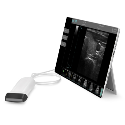 Medical Portable Color Ultrasound Doppler