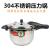 Jiaxing 304 Stainless Steel Pressure Cooker Composite Bottom Multi-Purpose Pressure Cooker Multi-Insurance Pressure Cooker Deep Stew Pot Soup Pot