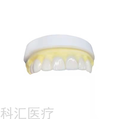 Teeth Whitening Veneer Tooth Patch Ceramic SMD