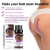 Eelhoe Hip Care Essential Oil Lifting and Firming Hip Lifting Peach Hip Hip Lift Body Shaping Massage Highlight Hip Curve